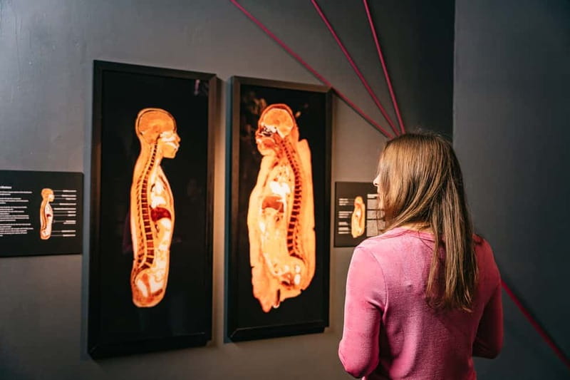 Berlin: Tickets for the BODY WORLDS Museum in Berlin - Price and Value Check: Is BODY WORLDS Worth $22 in Berlin?